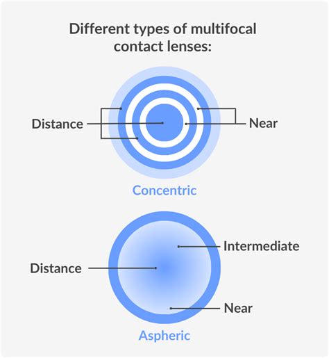 varifocal contact lenses reviews